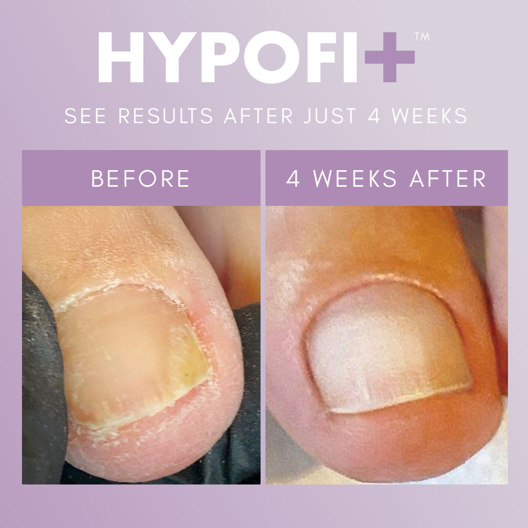 HypoFix Repair Serum 20ml by The GelBottle nourishing nail repair treatment