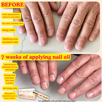 Nail Thoughts - Summer Forever Nail Oil 10ml